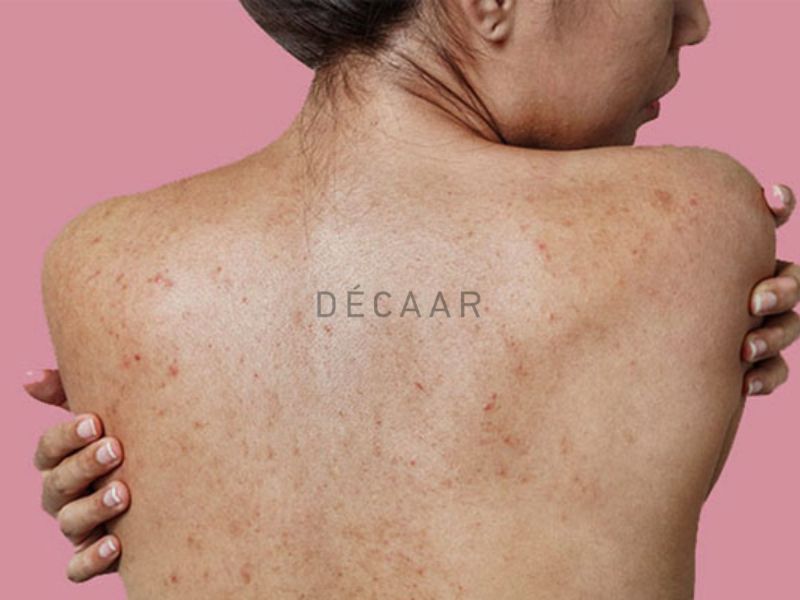 Môi trường ô nhiễm và các sản phẩm dưỡng da không phù hợp